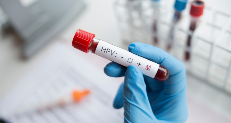 HPV: virus, ki lahko povzroči šest vrst raka in ga lahko preprečimo